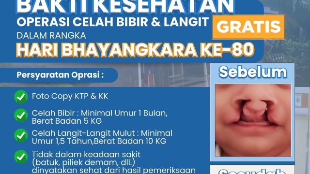 Semarak Hari Bhayangkara ke-80, Polda Banten Gelar Donor Darah dan Khitanan Gratis